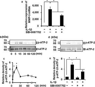 <h2>Suppression of IL-1β-induced MMP-3 mRNA expression by an ATF-2 inhibitor and IL-1β-induced ATF-2 phosphorylation.</h2>
