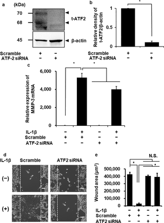 <h2>Attenuation of IL-1β-induced MMP-3 mRNA expression in fibroblasts transfected with ATF-2 siRNA.</h2>