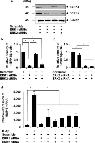 <h2>Attenuation of IL-1β-induced MMP-3 mRNA expression in the fibroblasts transfected with ERK1 and ERK2 siRNAs.</h2>