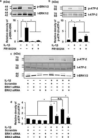 <h2>Attenuation of IL-1β-induced ATF-2 phosphorylation in fibroblasts transfected with ERK1 siRNA but not with ERK2 siRNA.</h2>