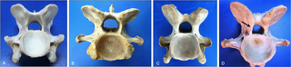 Progression in left-right asymmetry of the caudal articular processes (caudal views).