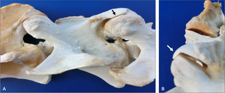 Lateral joint margin modeling (lateral and caudal views).