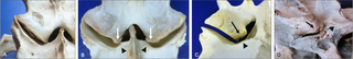 Progression in medial joint margin flattening associated with extension impingement (caudal views).