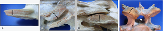 Progression in articular process thickening (lateral and caudal views).