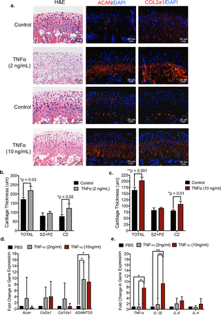 TNF-alpha increases extracellular matrix turnover and inflammatory cytokines in whole mandibular condyle explants.