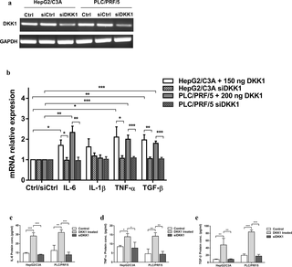 DKK1 promotes inflammatory cytokines secretion in hepatocellular carcinoma cell lines.