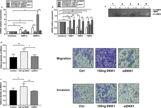 Recombinant DKK1 promotes the invasion and migration of hepatocellular carcinoma cell lines through shifting the MMPs/TIMPs ratio in favor of MMPs.
