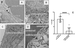 Electron micrographs of low dose exposure (0.15 μg/g body weight) of silica nanoparticles in the lungs of mice.