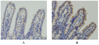 Expression of TLR4 in the terminal ileum (×200; immunohistochemistry).