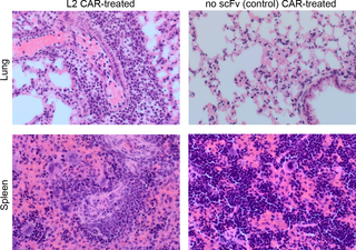 Histological analysis of mice treated with TEM8-specific or control CAR T-cells.