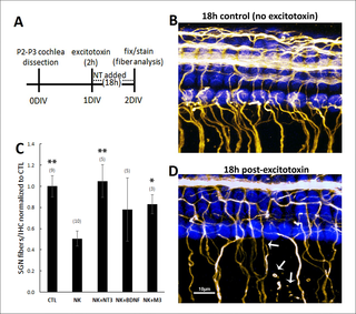 NT-3, BDNF and M3 restore SGN fiber density in organotypic cochlear explants after excitotoxic trauma.