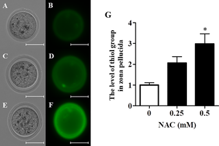 Effect of NAC on thiol levels in vitrified–warmed oocytes.