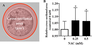 Effect of NAC on zona pellucida expansion in vitrified–warmed oocytes.