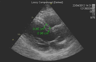 Echocardiographic parasternal long axis view.