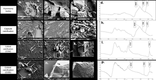 Illustration of the different patterns of crystals deposits in thyroid tissue using FE-SEM according to composition assessed by μFTIR spectrometry.