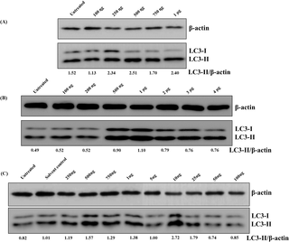 MIP lipids and DNA but not proteins induce autophagy in RAW 264.7 macrophages.