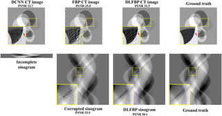 The sparse-view results of one synthetic phantom with an incomplete sinogram with 60 views by using DCNN [<em class="ref">32</em>], FBP and DLFBP.