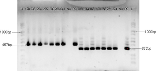 Agarose gel electrophoresis Image of HPV DNA genotyping with HPV-16 (457bp) and 18 (322bp) primers.