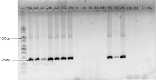Agarose gel electrophoresis Image of HPV DNA genotyping with HPV-31 E6/E7 primers.