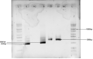 Agarose gel electrophoresis Image of HPV DNA genotyping with HPV-6 (334bp), 35 (358bp) and 33 (398bp) primers.