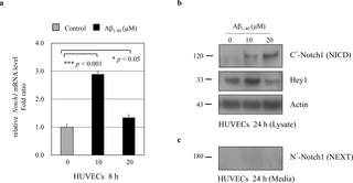 Modulation of Notch1 expression in HUVECs by amyloid beta (Aβ).