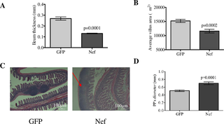 Hippocampal HIV-1 Nef expression decreases ileal tissue thickness and villi area and induces highly reactive follicular hyperplasia.