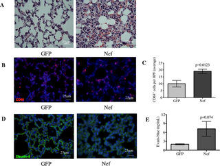 Nef expression in the rat hippocampus induces interstitial pneumonitis and increases macrophage infiltration and vascular permeability in the lung.