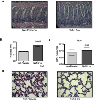 IL1ra administered intracerebroventricularly in rats expressing hippocampal Nef inhibits the development of ilium structural changes, tissue thickening, and lung interstitial pneumonitis.