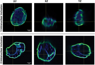 3D nuclear imaging with lamin AC immunofluorescence in X-, Y- and Z-axis.