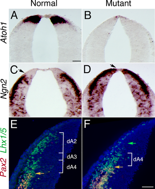 Expression of specific markers of rhombic lip demonstrates that the most dorsal precursors were lost and that ventral markers were shifted dorsally in the caudal rhombic lip in <i>Bmpr</i> double knockout animals.