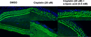Effect of α-lipoic acid (LA) on cisplatin-induced cytotoxicity in organ of Corti explants.