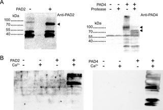 Human PAD2 and PAD4 expression in <i>E</i>. <i>coli</i> and <i>in vitro</i> citrullination activity.