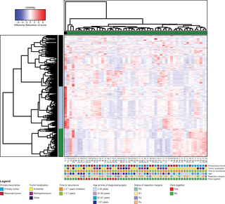 Hierarchical clustering based on differentially methylated DNA regions (DMRs) between primary and recurrent WDLPS samples.