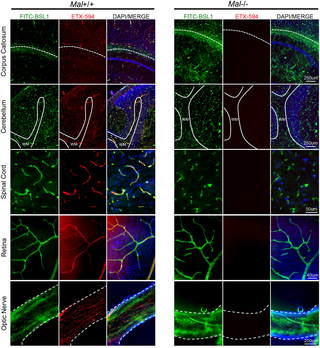 Epsilon toxin binds to the microvasculature of the CNS and requires expression of MAL.