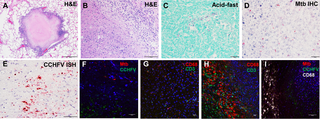 Histologic, acid-fast, IHC, ISH, and IFA findings in the tissues of CCHFV-infected cynomolgus macaques.