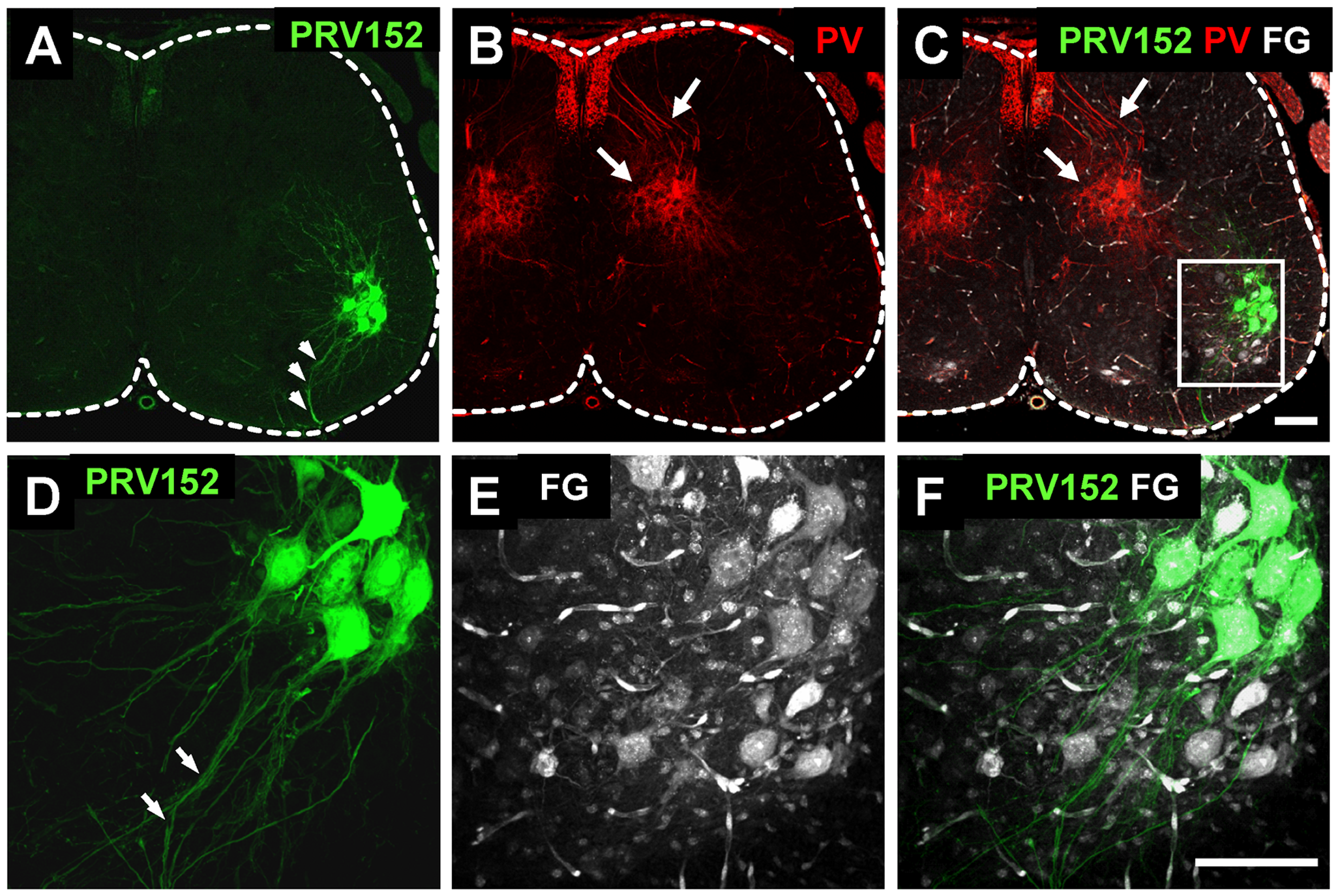 Plos One The Use Of Prv Bartha To Define Premotor Inputs To