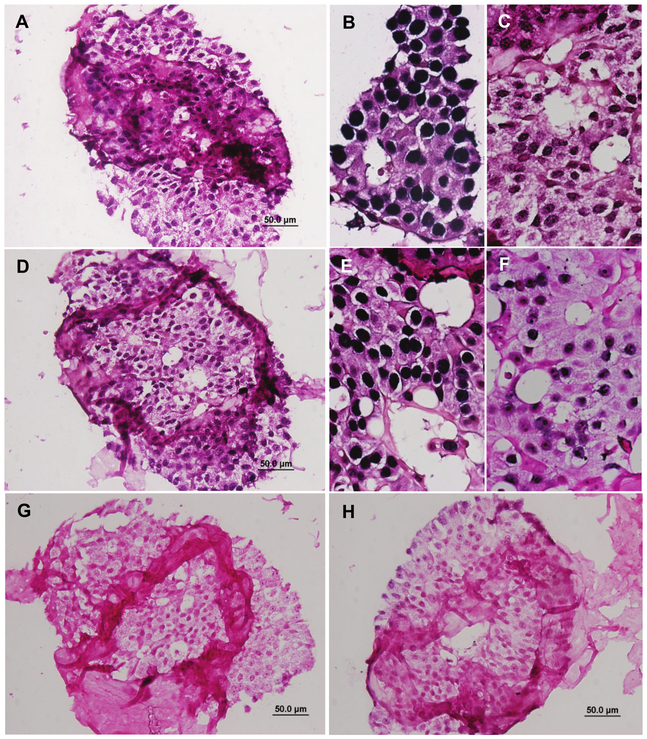 Plos One Epstein Barr Virus Human Papillomavirus And Mouse Mammary Tumour Virus As Multiple Viruses In Breast Cancer